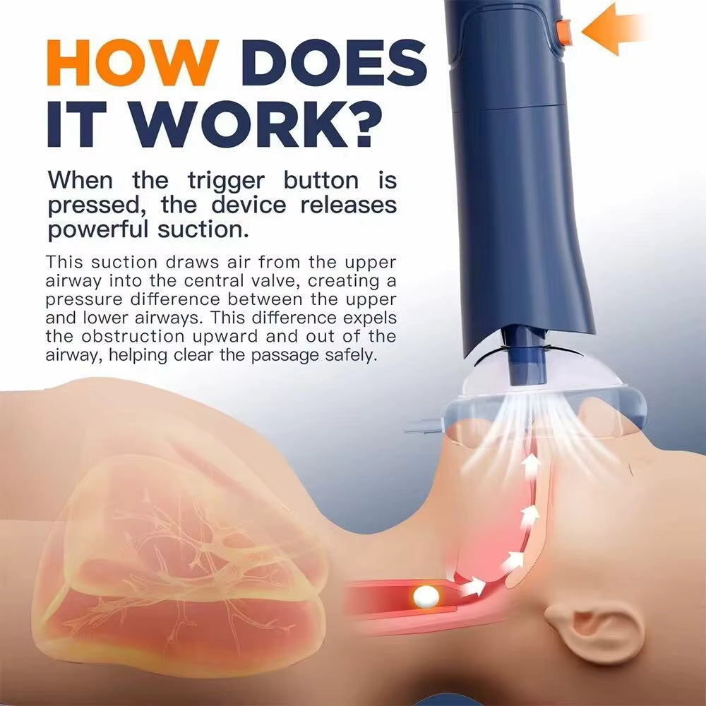 Anti-Choking Device (Emergency First Aid)